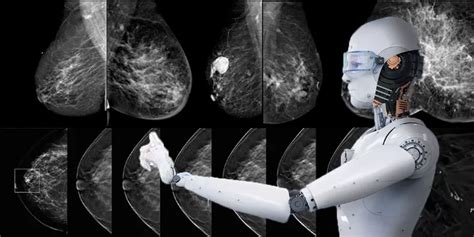 the villages breast cancer detection|AI successfully helps detecting more breast cancers around .